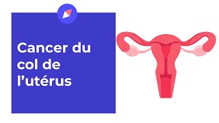 Cancer du col de l'utérus : symptômes et traitements