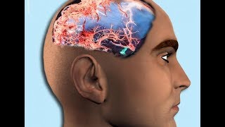 La neuroscience révèle enfin ce que le jeûne fait à votre cerveau